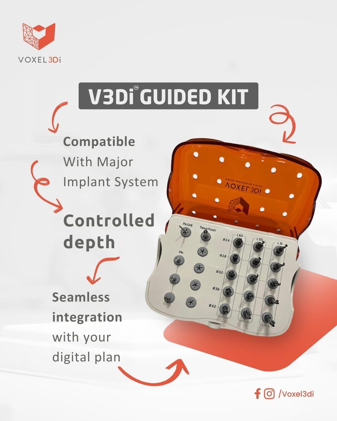 V3Di Guided Kit — Compatible, Controlled, Seamless
