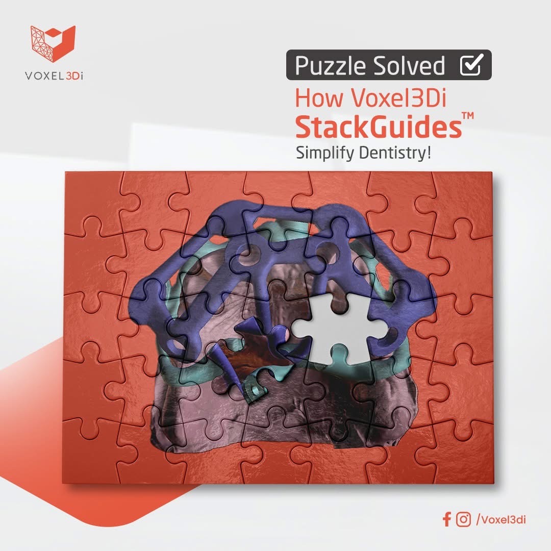 Puzzle Solved — How StackGuides Simplify Dentistry